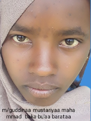 Musteria Mohammed Abdela 